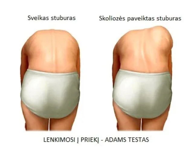 ADAMS testas INNOVAMED ADAMS testas INNOVAMED
