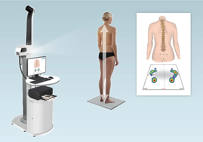 SPINE 3D INNOVAMED SPINE 3D INNOVAMED