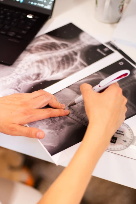 Skoliozės edukacija mokykloms INNOVAMED